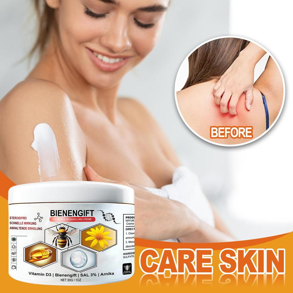 30g Bee Venom Body Cream Body Skin Nourishing Moisturizing Discomfort Relieving Care Daily Massage Applicator Cream