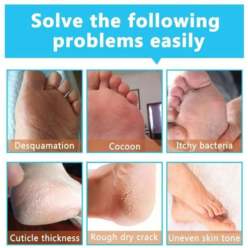 Nourishing Honey Milk Peel-off Hand And Foot Mask For Deep Hydration And Silky Smooth Skin