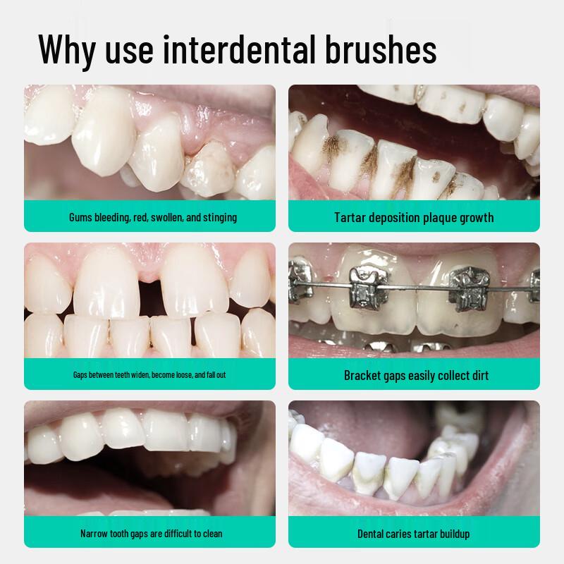 meyarn Interdental Brushes