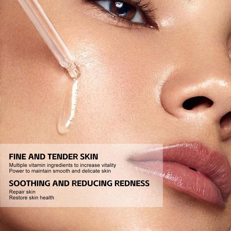 Eelhoe Clear Skin Willow Bark Essence Nourishing Moisturizer For Dry Skin And Acne Scars