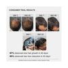 Bare Anatomy Advanced Hair Growth Serum - 30ml