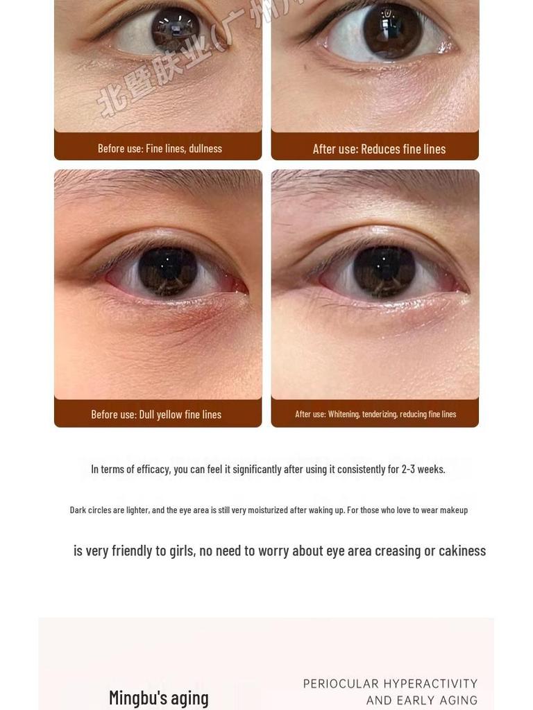 Véritable Crème Fermeté Yeux: Anti-rides, Cernes & Poches, Hydrate & Réduit les Ridules