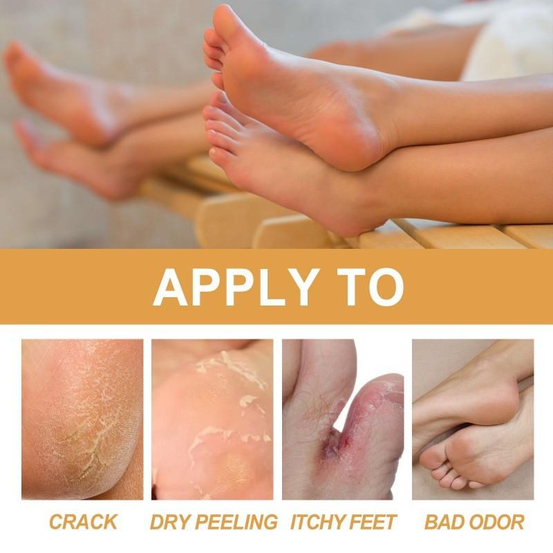 Nourishing Ouhoe Foot Spray For Softening Rough Skin And Removing Dead Skin Cells