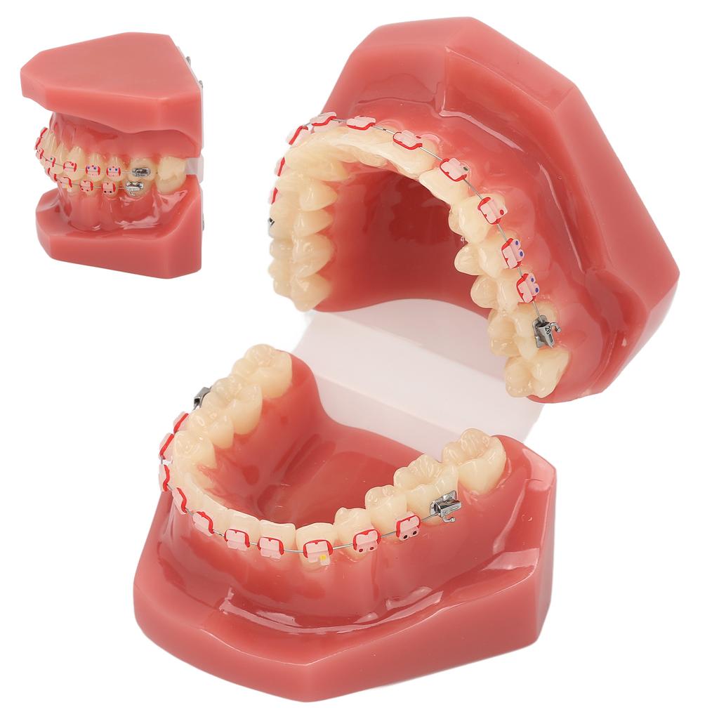 Ceramic Dental Orthodontic Demonstration Model Teeth Model with Metal Wires and Bracket for Teaching Learning