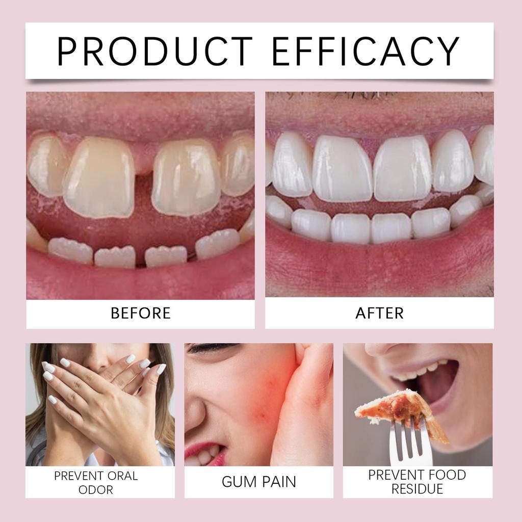 Oralhoe Haftcreme für Prothesen 28g 24-Stunden sicherer Halt + Komfortabel und unsichtbar! Geeignet für Voll-/Teilprothesen