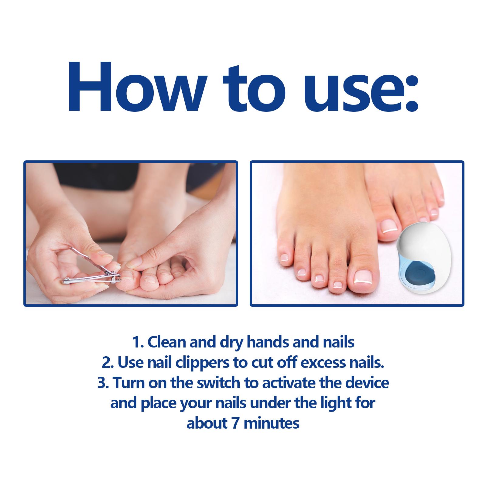 

-Nail Device Nail Fungus Cleaning Device Nail Fungus Treatment for Damaged Discolored Thick Toenails & Fingernails