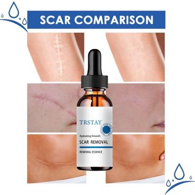 Cream Skin Wound Cream Burning Fading Cream Surgery Repair Scar Skin Care  Skin Whitening Cream Crema Para Manchas De La Cara