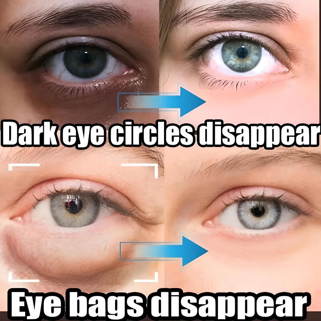 1720eac6e577503d2f89c3e80467edcd208d1031