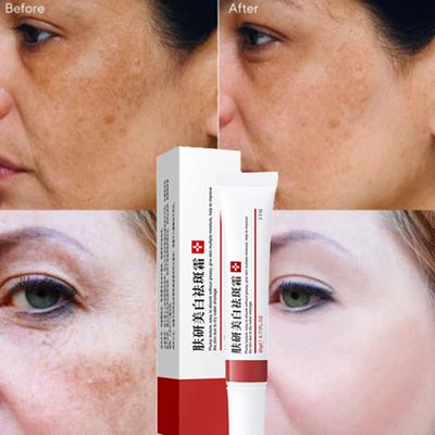 Crema de albire pentru pistrui Elimina Melasma Acneea Pigment Melanina Crema de fata