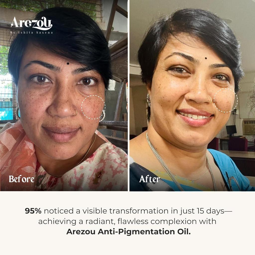 Arezou Anti-Pigmentation Face Oil for Dark Spots | Brightening Treatment for Dry Skin | Hyperpigmentation with Lavender Oil | (0.50 Oz / 15 Ml)