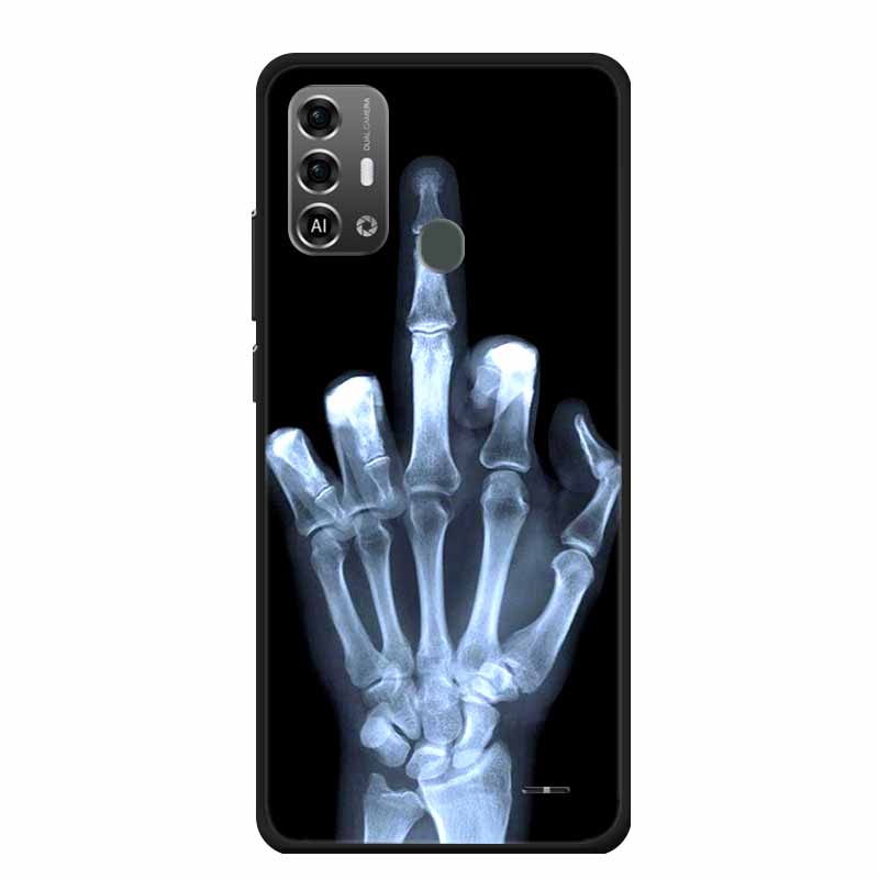 For ZTE Blade A53 Pro Case A53+ Fashion TPU Soft Protective Silicone Back Covers For ZTE Blade A53 Plus Animal Etui A53Pro Capas