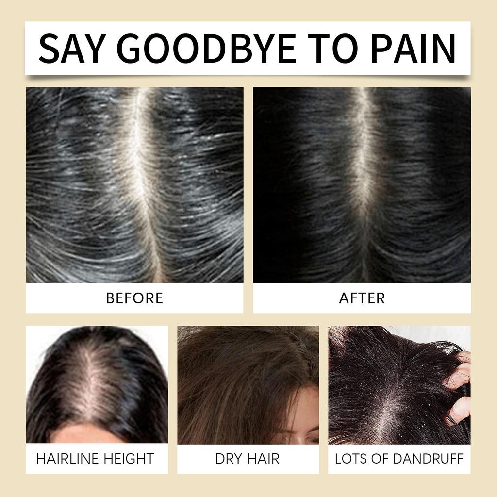 Plant-based Anti-hair Loss Oil Moisturizes, Protects And Strengthens Hair, Suitable For Sensitive Scalp,60ML