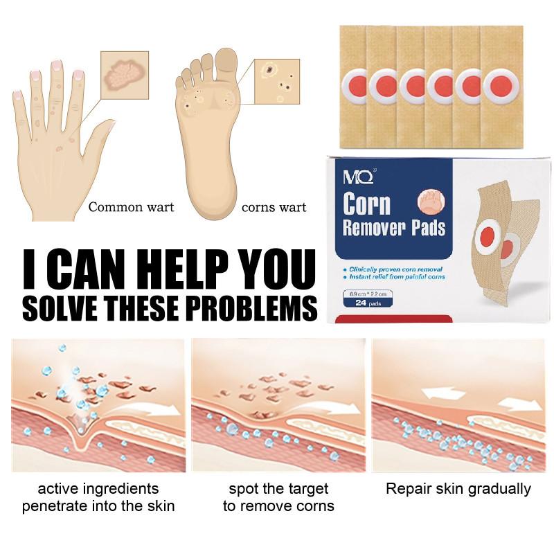 Corn Pads Remover Foot Plaster Healthcare Supplies Convenient Tool Effective