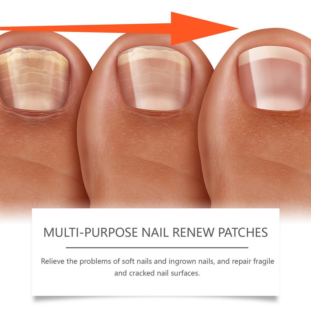 Nail Care Patches For Maintaining Nail , Cleaning, And Daily Moisturizing. Nail Care Patches