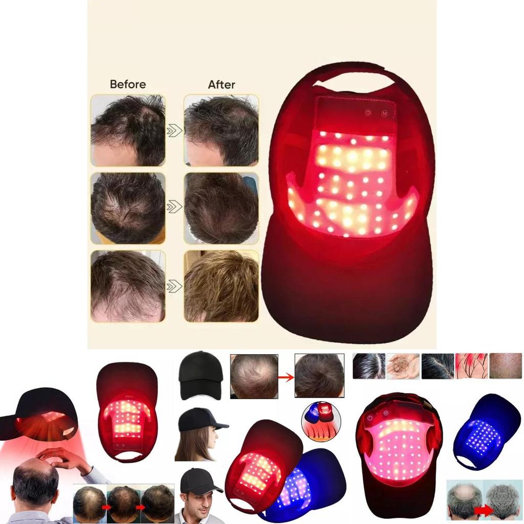 Lazer Kırmızı LED Mavi Işık Terapisi Saç Büyüme Şapkası Hızlı Yeniden Büyüme Saç Dökülmesine Karşı
