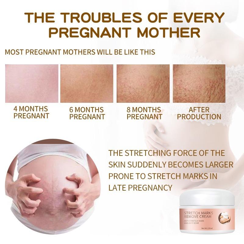 Private Label 100% Natural Vegan Effective Anti Postpartum Deep Acne Scar Skin Whitening Maternity  Removal Cream