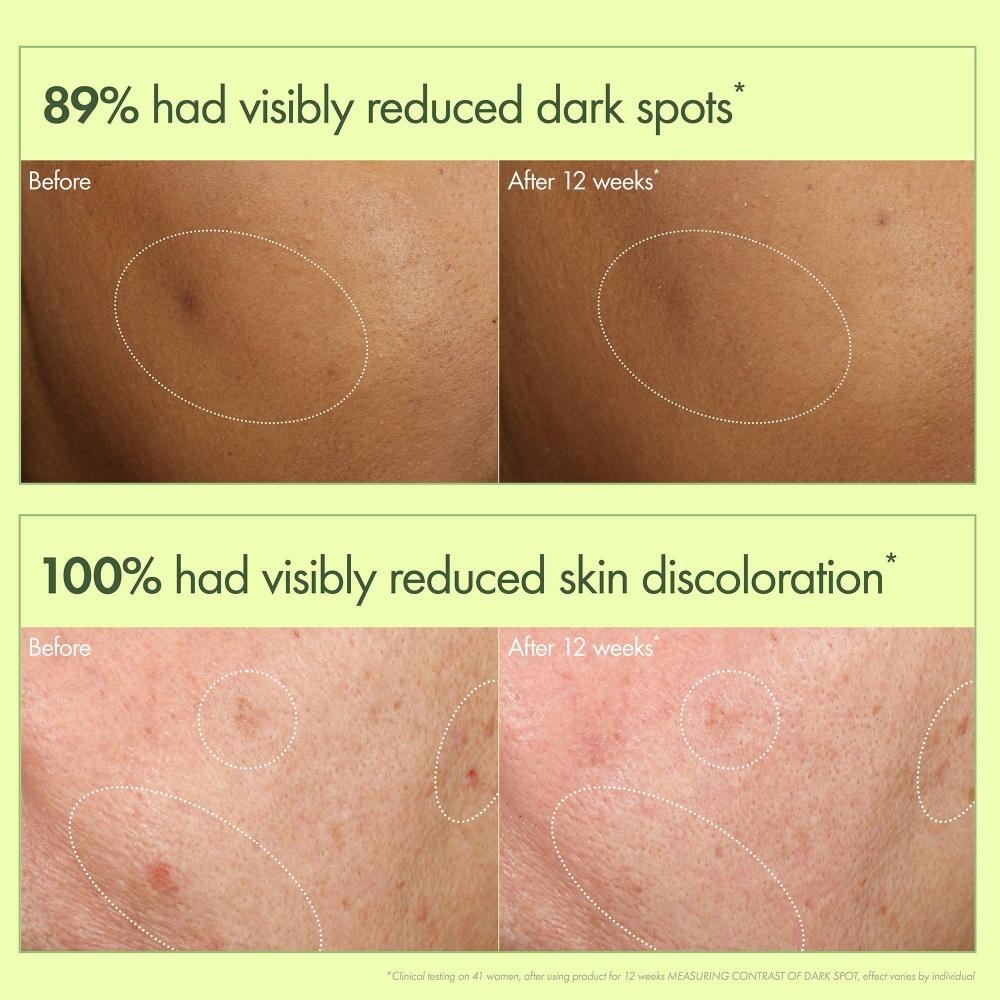 Origins Mega Mushroom Dark Spot Brightening Face Serum 1.0 Oz