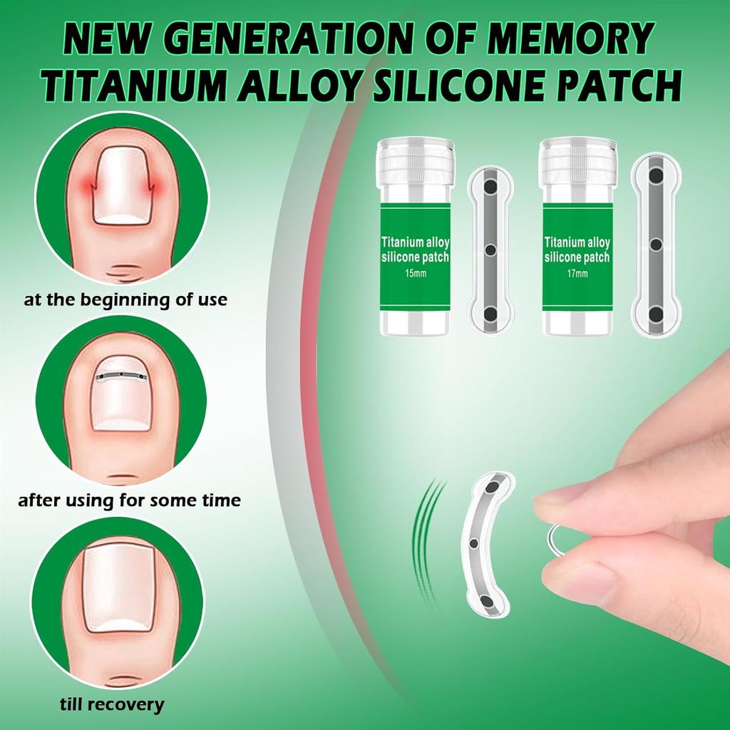 Entwickelt für die Reparatur gebogener Nägel und zur Korrektur eingewachsener Zehennägel, Nagelwerkzeuge und ein Set zur Entfernung eingewachsener Zehennägel