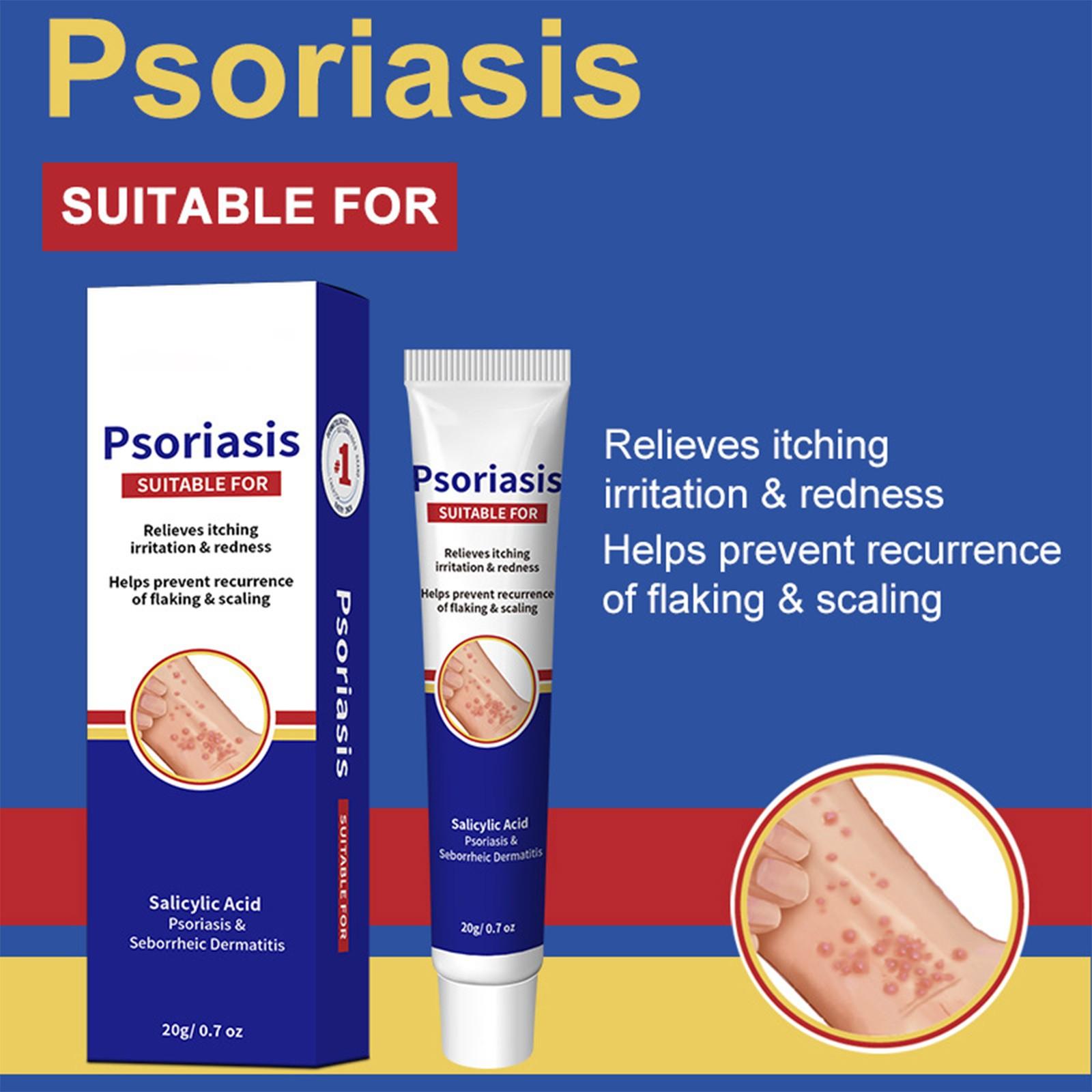 

Крем от экземы 20 г, Крем от зуда и грибка, Крем для ухода за кожей для облегчения зуда и успокоения кожи One Size белый