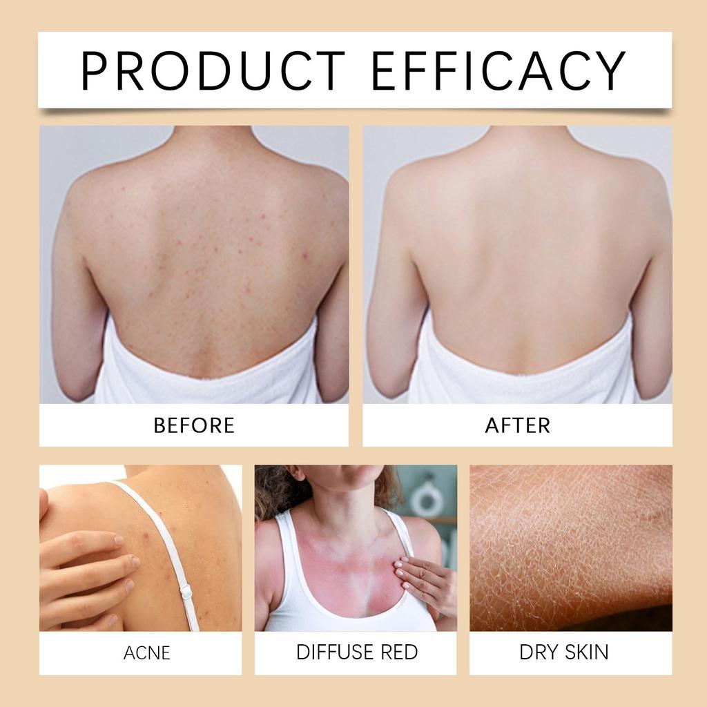 Řada tělových olejů: Vyživuje kolena, Čistí a zjemňuje suchou drsnou pokožku, Dlouhotrvající vůně s bělícím účinkemS 30ml