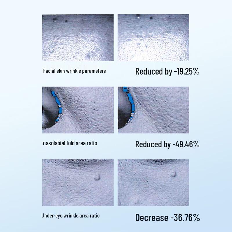 WIS Recombinant Collagen Ampoule Serum 1.5ml X 5-Pack