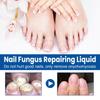 Onychomycosis Solution, Thickening Bright Onychomycosis Remover, Soft Onychomycosis, Hand And Foot Nail Care Solution 30ml