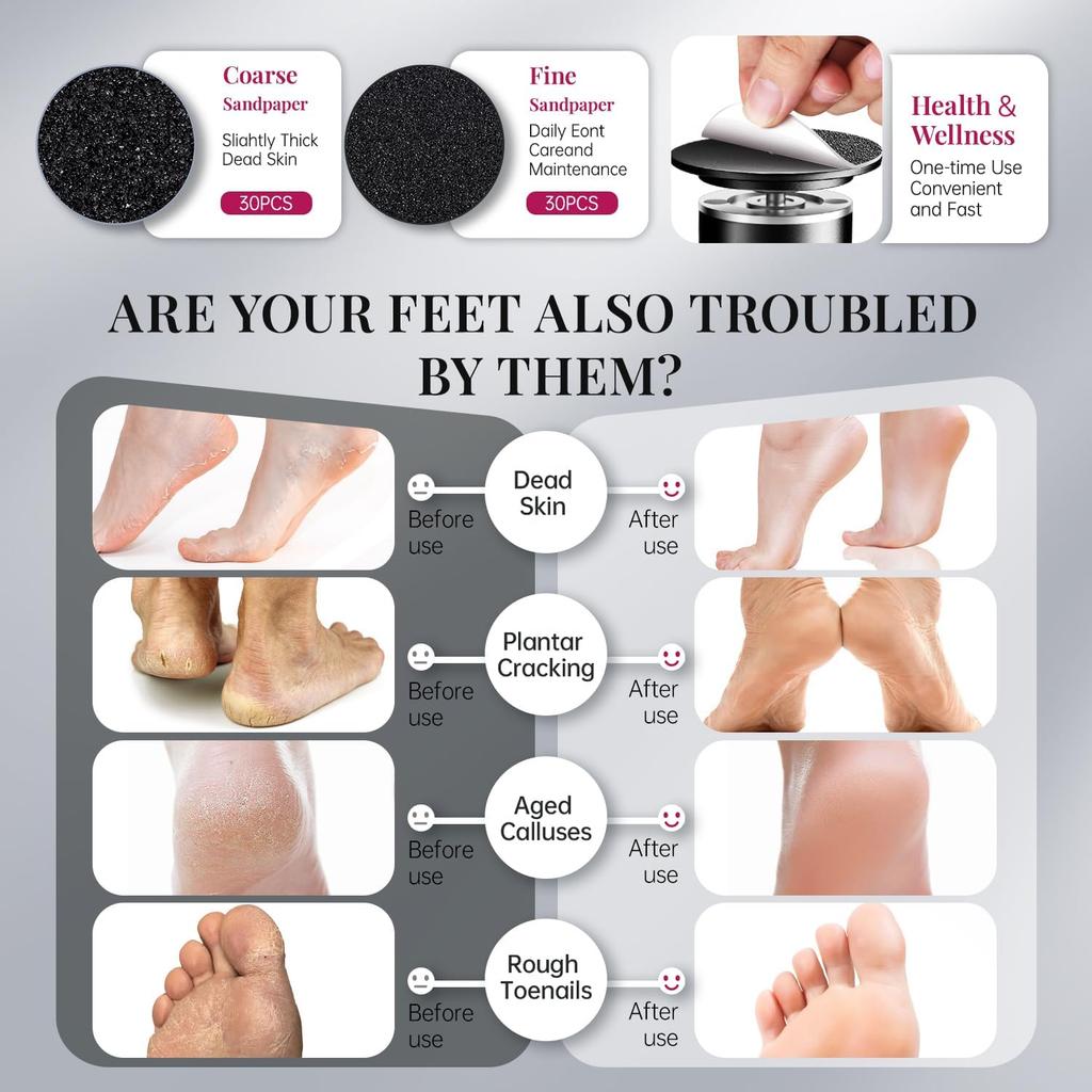 Electric Callus Remover - Professional Aluminum Foot File Adjustable Pedicure Tool with Sandpaper Discs