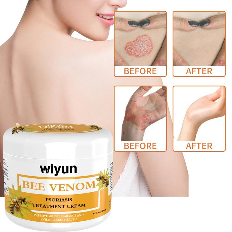 Premium Wiyun Bee Venom Skin Cream For Repairing Dry And Itchy Skin With Soothing Hydration