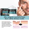 Anti-Wrinkle Cream for Men Mild Moisturizing Removing Wrinkles Firming Lifting Neck Fade Fine Lines Anti-Aging Facial Treatment
