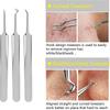 Tweezer Acne Pimple Extractor Blackhead Removing Skin Care Tool Kit Face Care Tool Pimple Removing