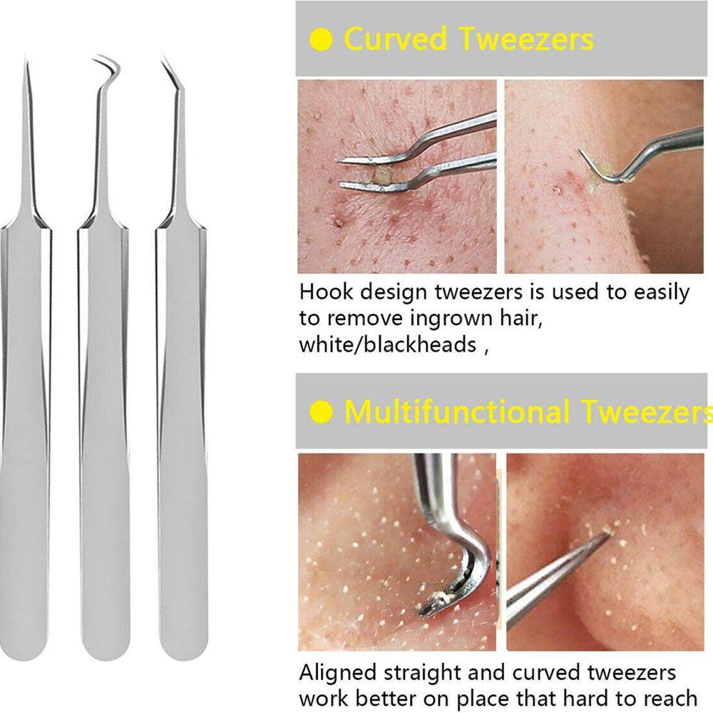 Tweezer Acne Pimple Extractor Blackhead Removing Skin Care Tool Kit Face Care Tool Pimple Removing
