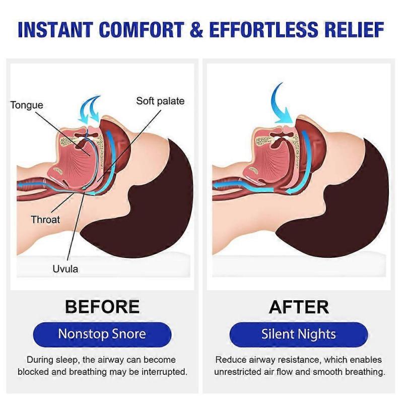 Anti-Snoring Nasal Spray, Natural Solution for Snore Relief, Fast Snore Stopper 2025