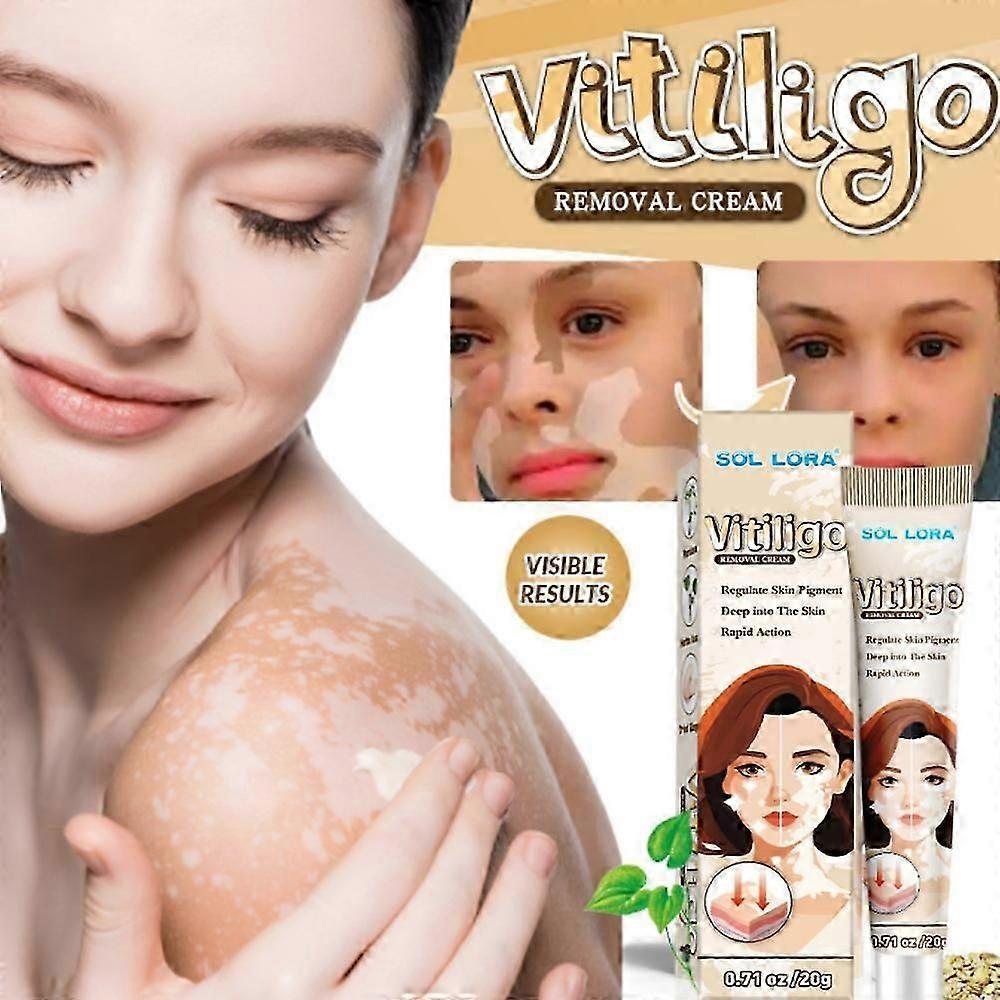 Vitiligo Cream, Anti-Vitiligo Cream, Reduce White Spots and Improve Skin Pigmentation, 20g