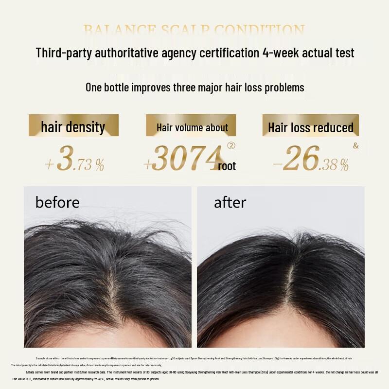 Siyuan Ginger Anti-Hair Loss Shampoo for Oily Scalp