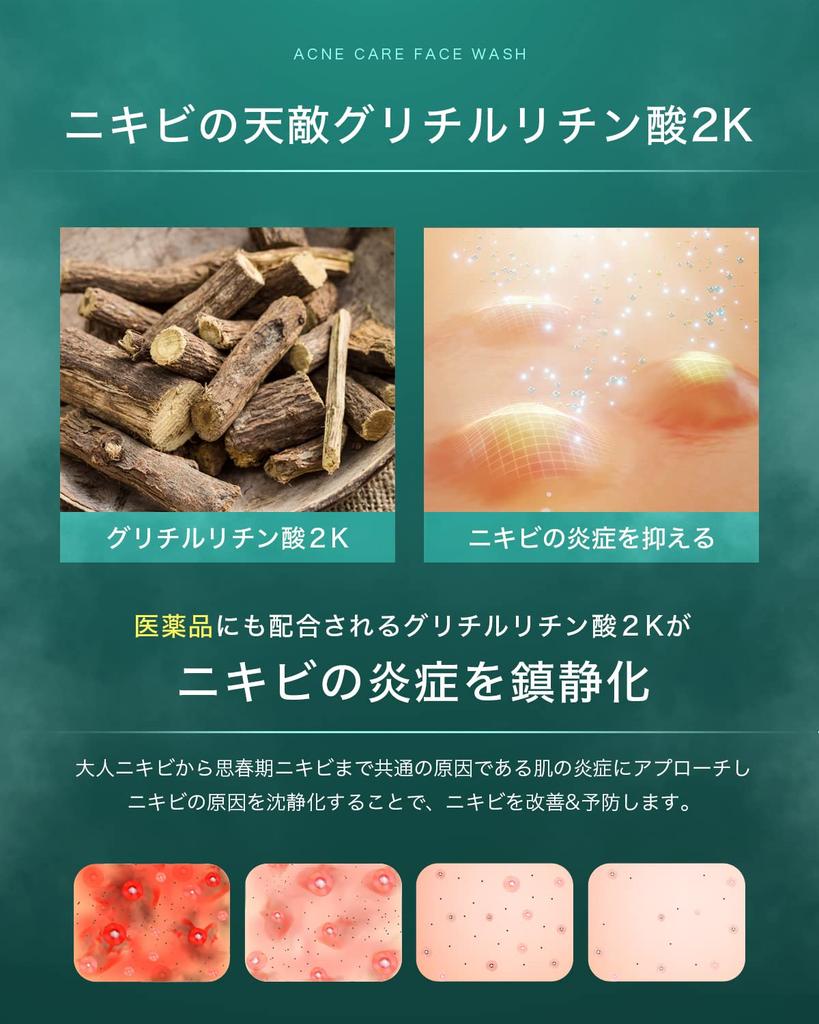 Nile Dense Foam Facial Cleanser for Acne and Cream Facial Soap Cleansing EUCALYPTUS MINT Pores, Quasi-Drug (Includes Net, Scent)