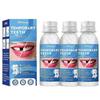 1-3X Resin Tooth Repair Glue Shapeable Teeth Gaps Filling Solid Glue Temporary Teeth Repair Falseteeth Glue Safety Dental Supplies