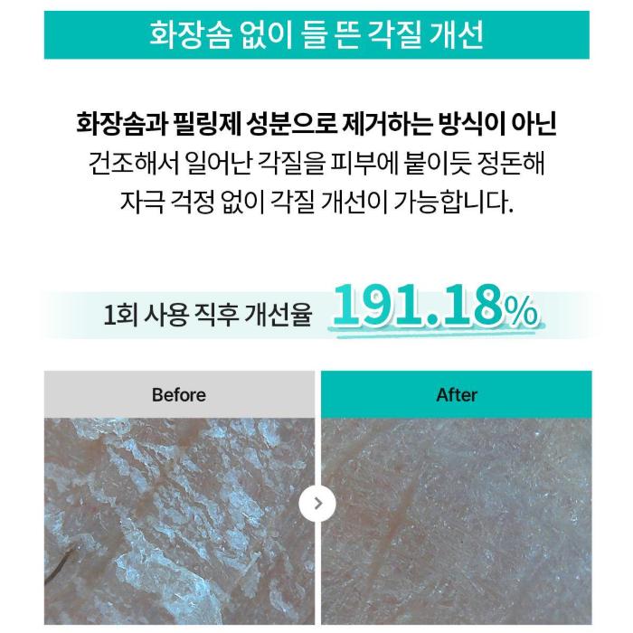 Rejuran Derma Healer Moisture Treatment Toner Skin Repair & Hydrating Care 150ml