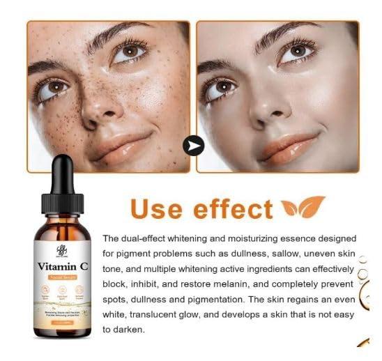 ZeroLuxury® Vitamin C Face Serum, Anti-Aging & Brightening for Radiant Skin Serum And Moisturizing Face Serum For Men & Women -30ML