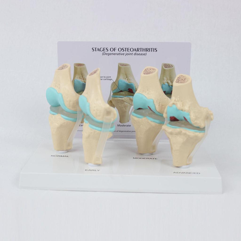4-Stage Human Knee Evolution Model for Teaching and Display