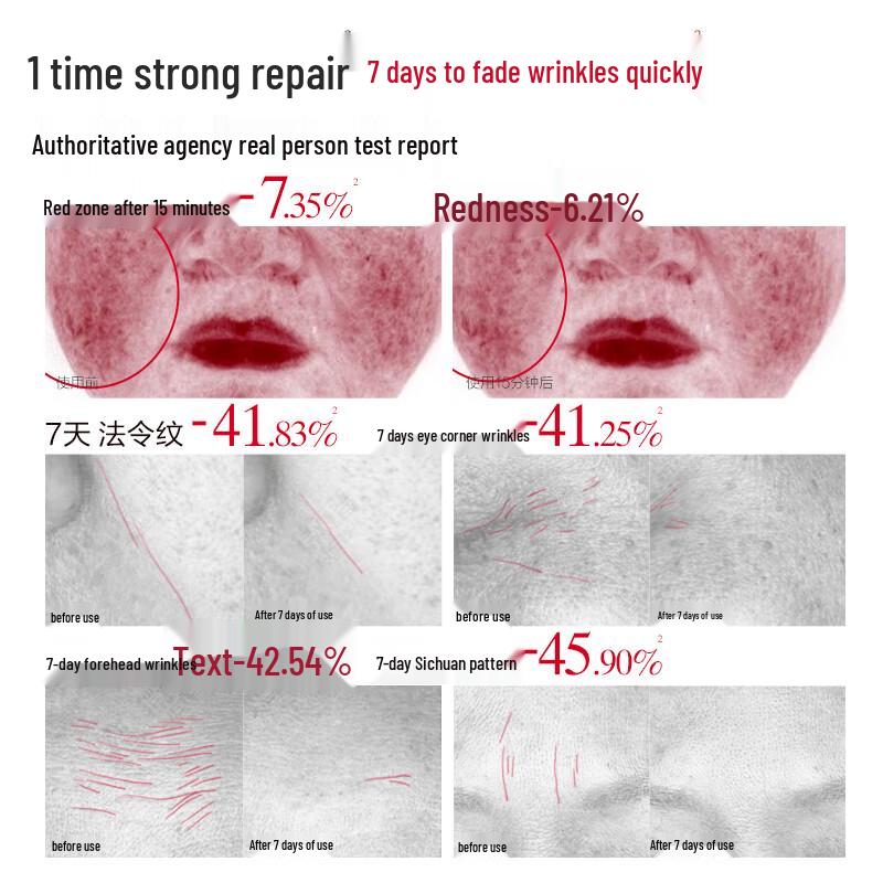 Wanmei Second Gen Collagen Anti-Wrinkle Facial Essence Set