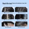 EHD Anti-Dandruff & Anti-Hair Loss Shampoo Set