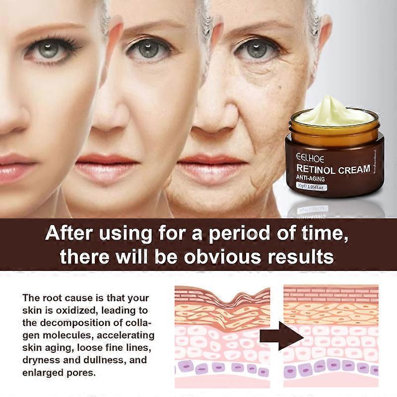 Retinol Wrinkle-Removing Cream