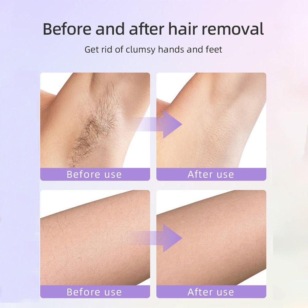 3 Customizable Speeds Hair Removal Device 2-in-1 Design Dermaplane Razor  Women's Hair Removal