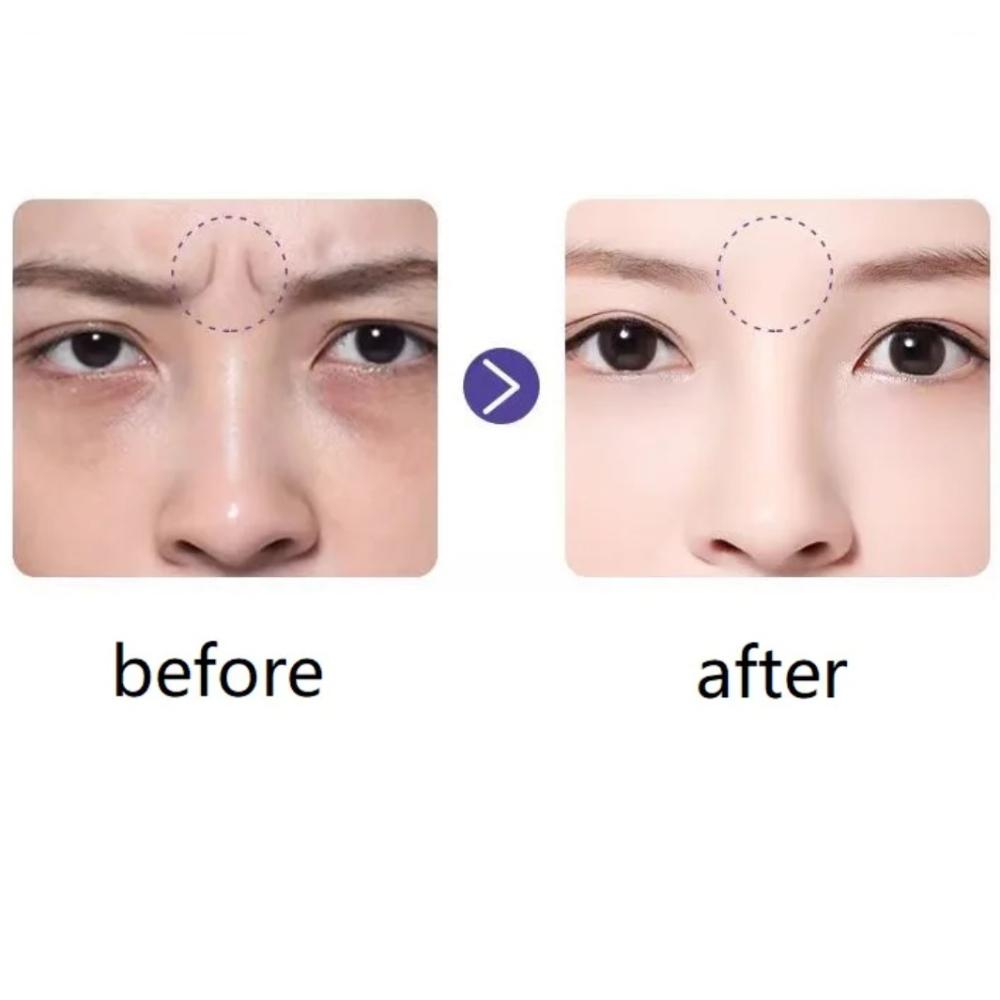Thin Facial Line Stickers Anti-Wrinkle Patches for Sagging Skin Lift Up Tape for Frown & Smile Lines Forehead