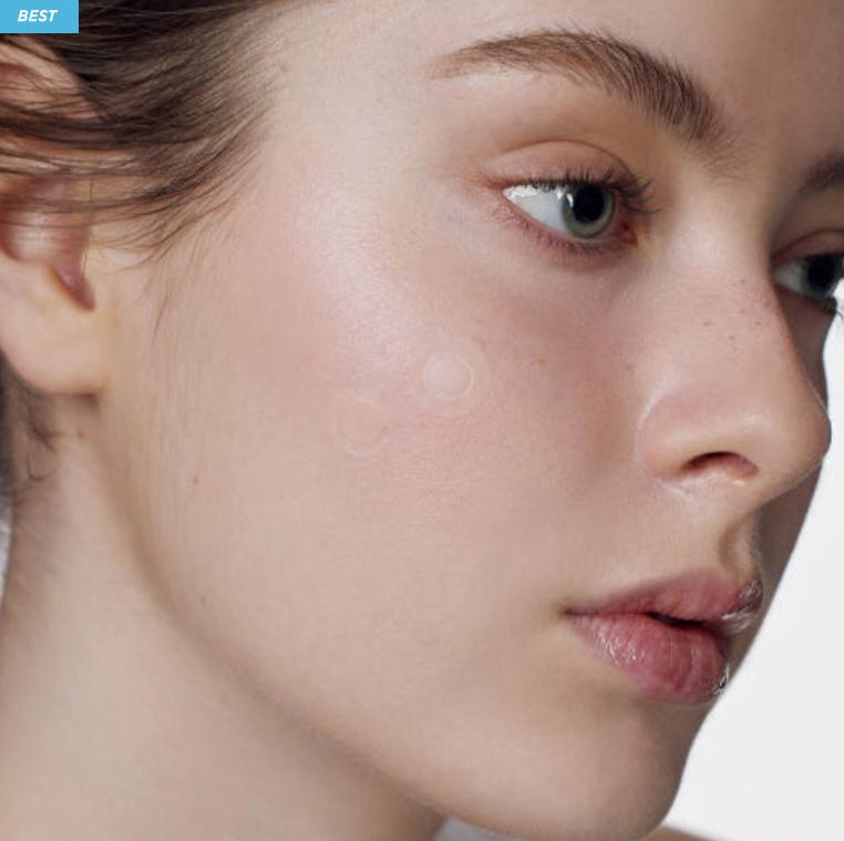 SOME BY MI Miracle Micro Pin Patch 9 Sheets | Acne Spot Treatment | Korean Skincare
