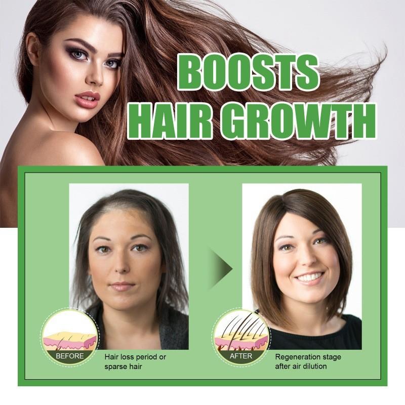 Eelhoe Castor Oil Hair Growth Serum Nourishing And Strengthening 30ml For Thicker Hair