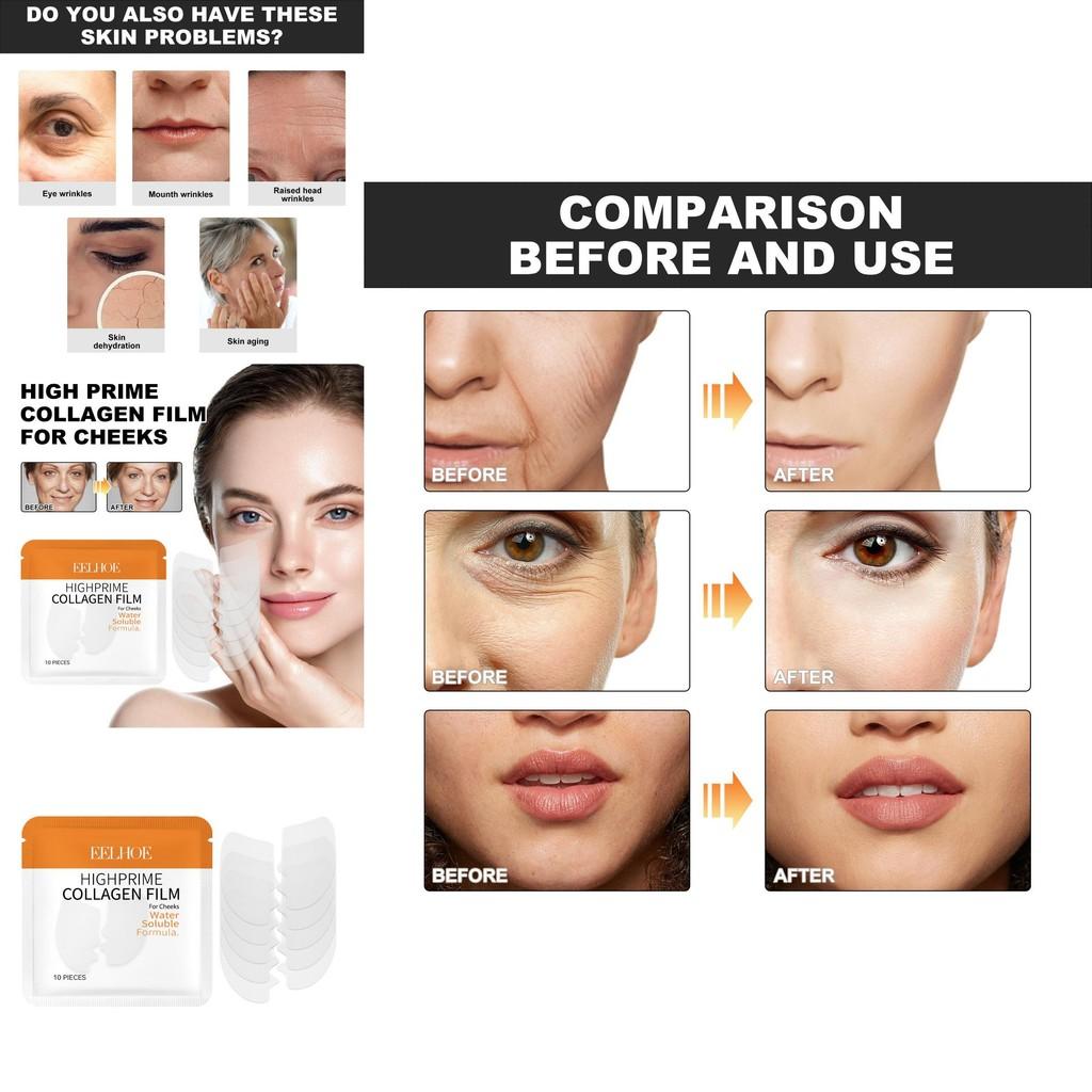 Eelhoe Collagen Water Soluble Face Cheek Patches For Wrinkle Reduction And Hydration