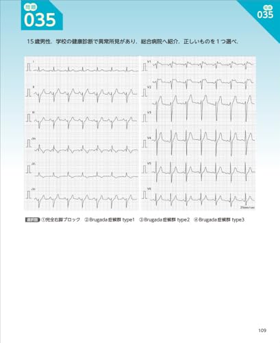 160 ECG Questions & Thorough Explanations To Pass Level 2 & 3 Exams - Get Stronger for the Actual Exam with Randomly Selected Practice Questions and P