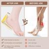 3 Pairs Thick Heel Protectors Anti Friction Inserts Secures Adhesive Backing Shock Absorption Perfect for Women Shoe