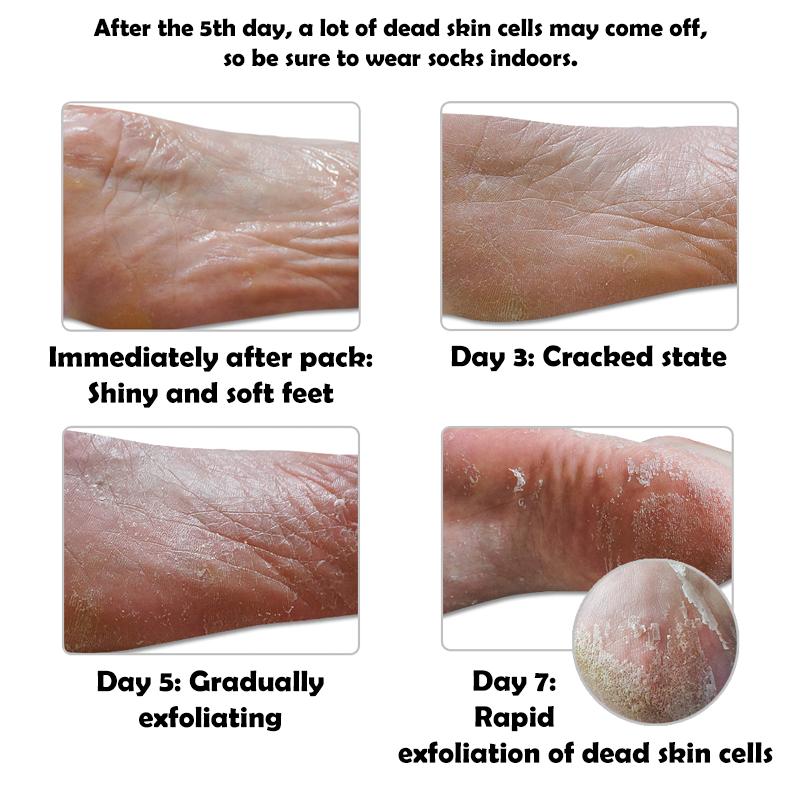 Elizavecca Piggy Hell Fore Turtle's Foot Pack A Pair 40g (2 Different Quantities)